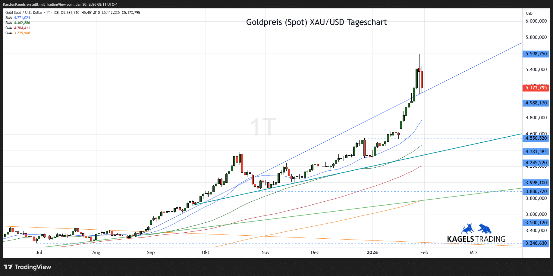 Goldpreis Prognose - heute, morgen, nächste Woche (2026)