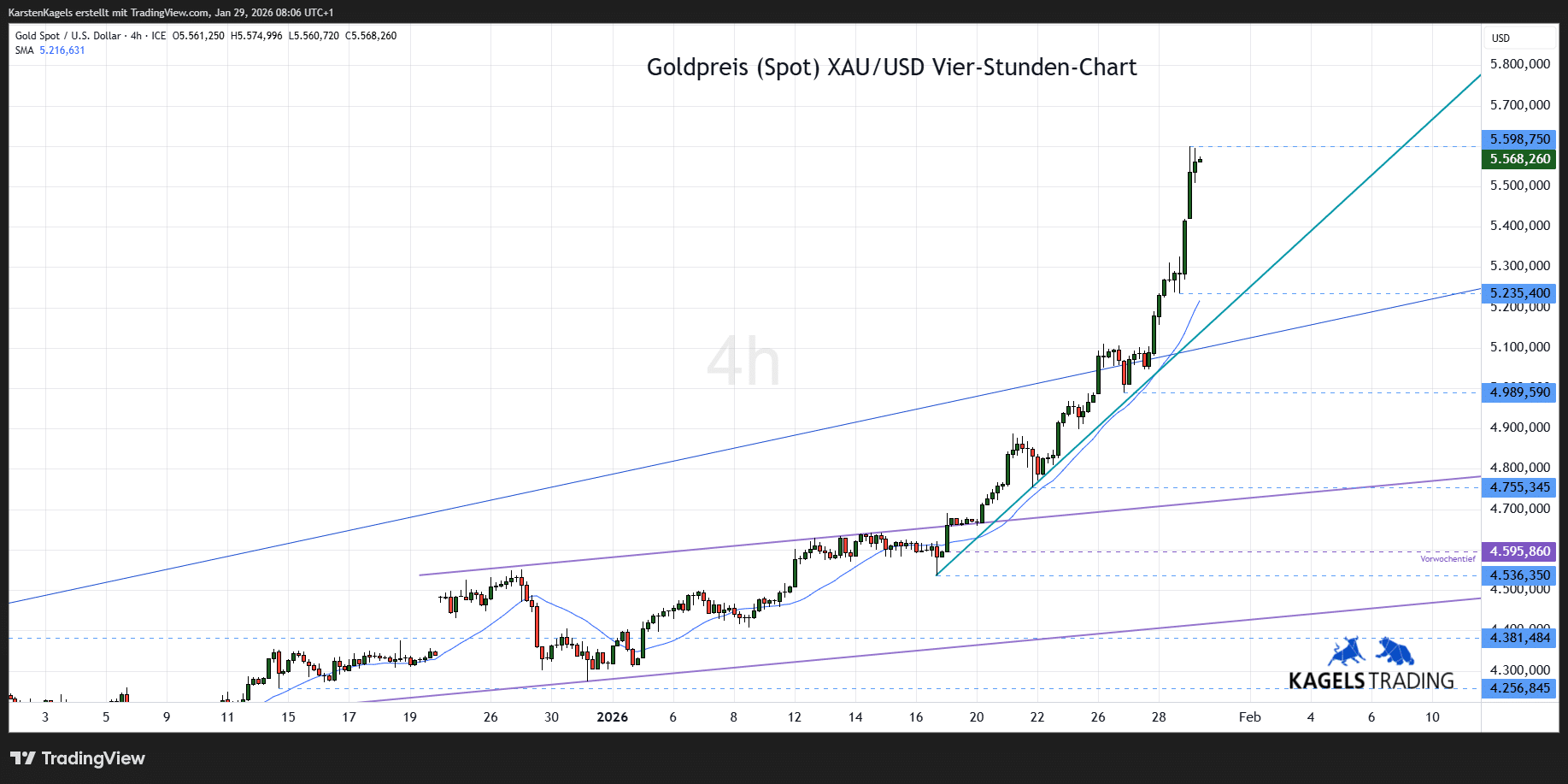 Goldpreis Prognose - heute, morgen, nächste Woche (2026)