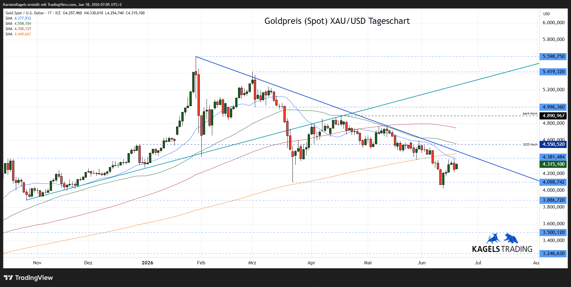 Gold Prognose Tageschart - diese und nächste Woche (Chart: TradingView)